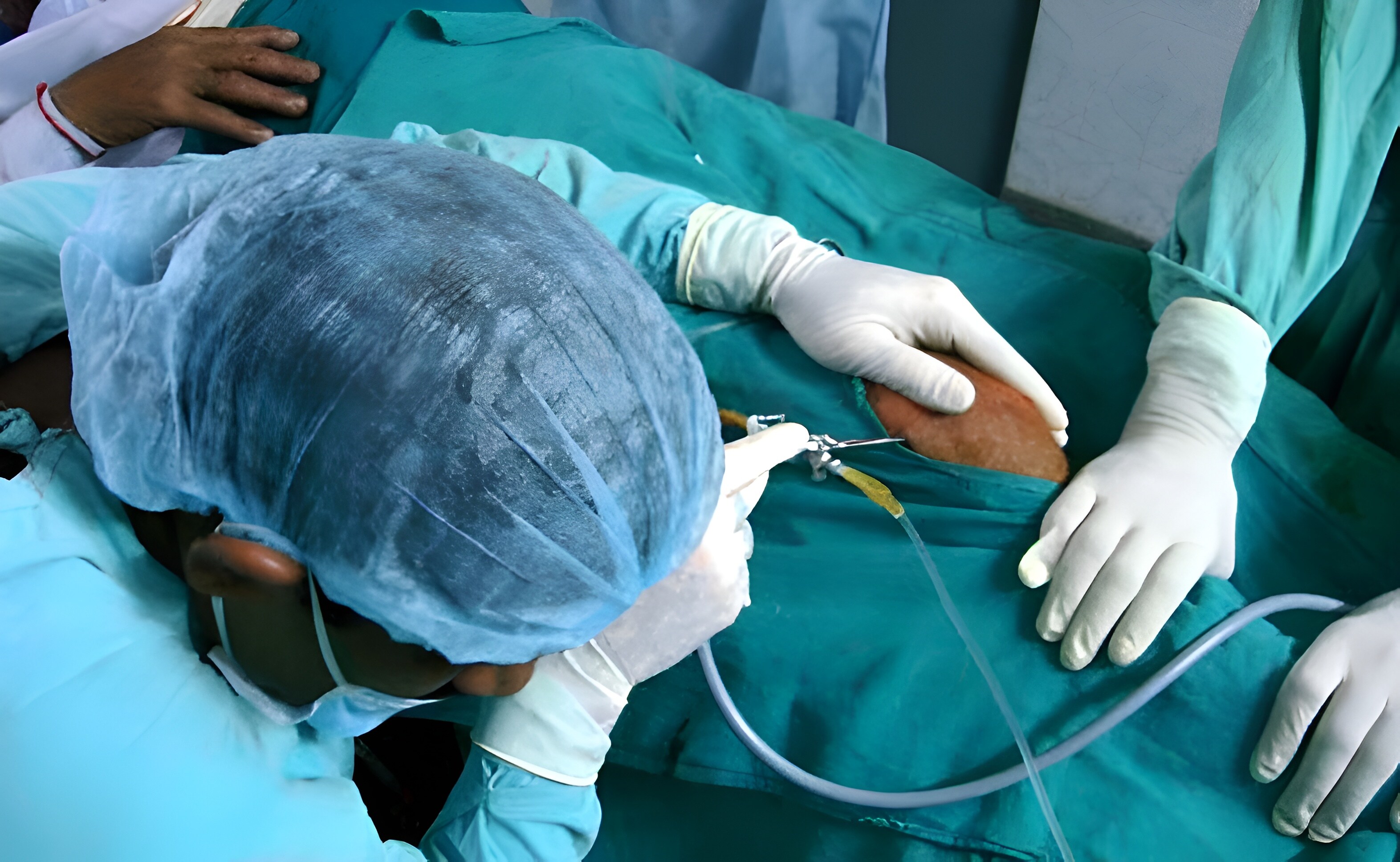 Surgical procedure in progress at Brij Medical Centre, Kavi Nagar, Uttar