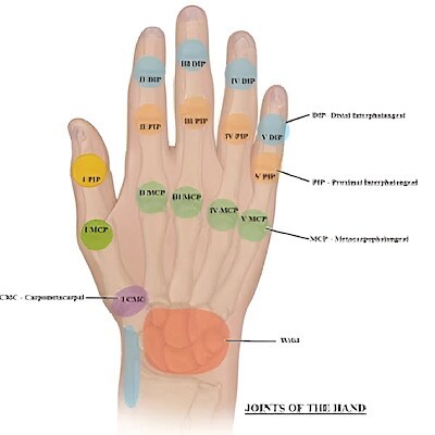 Clinical Disease Activity Index