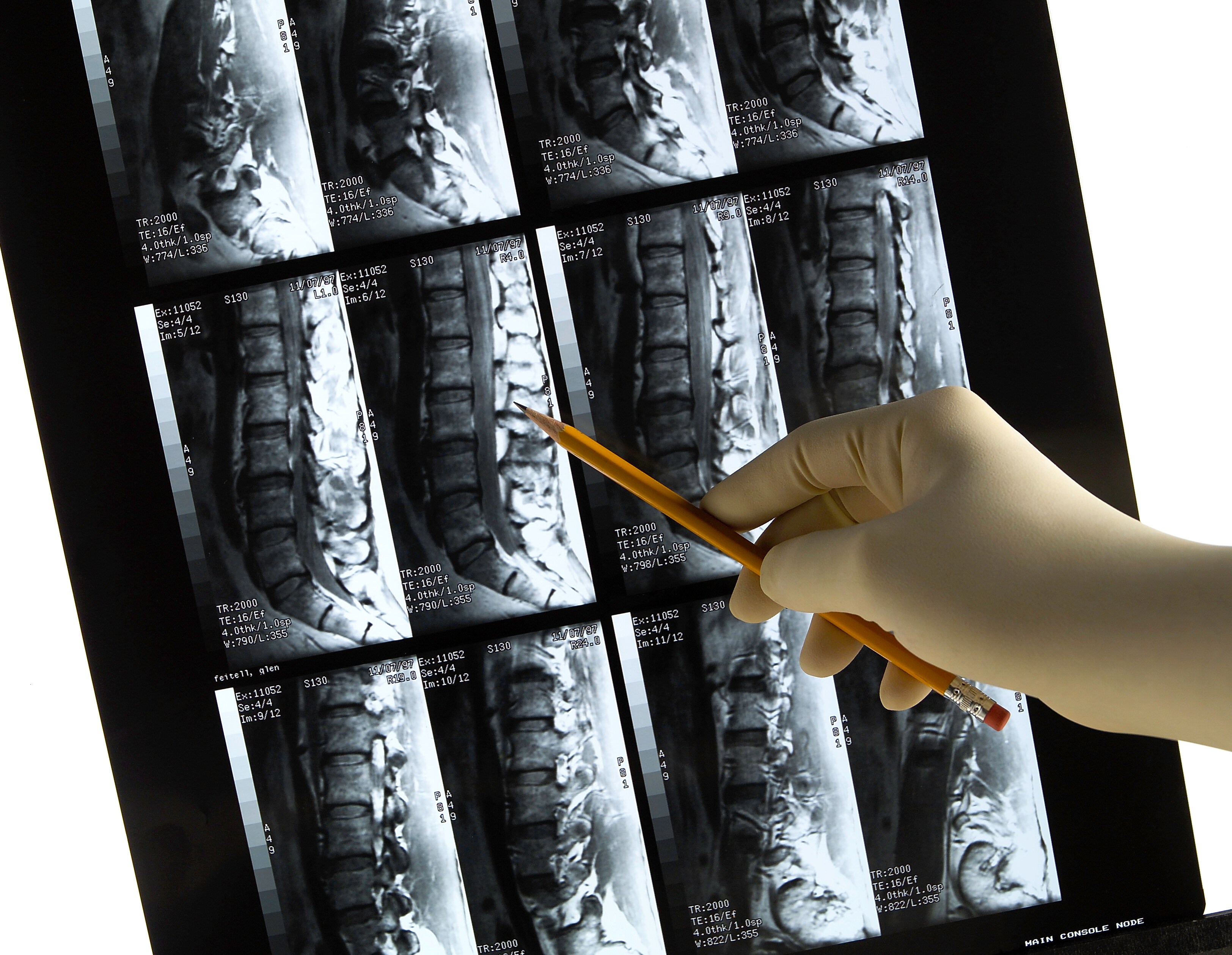 A hand points at medical imaging at Brij Medical Centre, Kavi Nagar, UP.