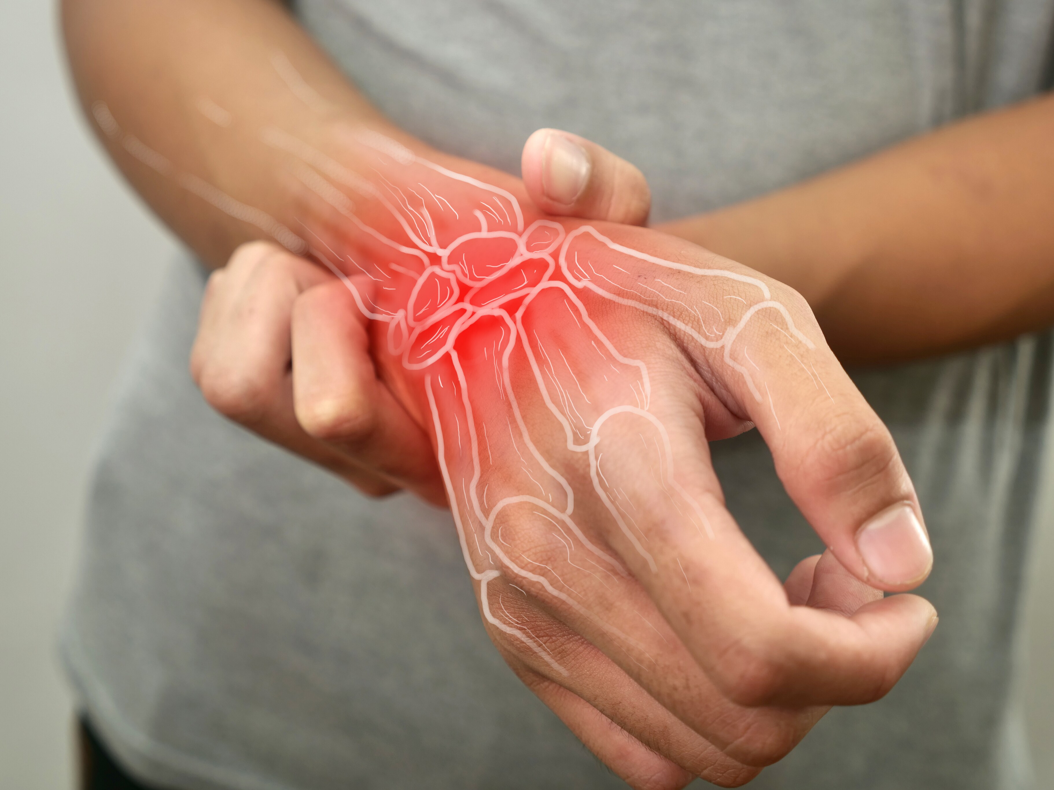 A person experiencing wrist pain at Brij Medical Centre, Kavi Nagar, UP.