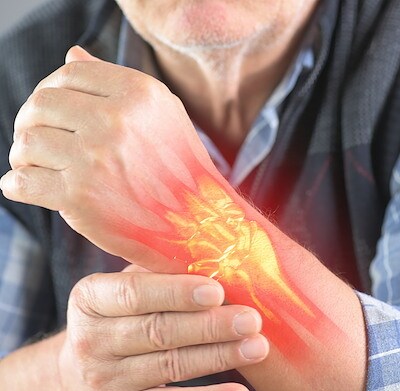 Apca Test rheumatoid arthritis treatment in ghaziabad | Arthritis Care