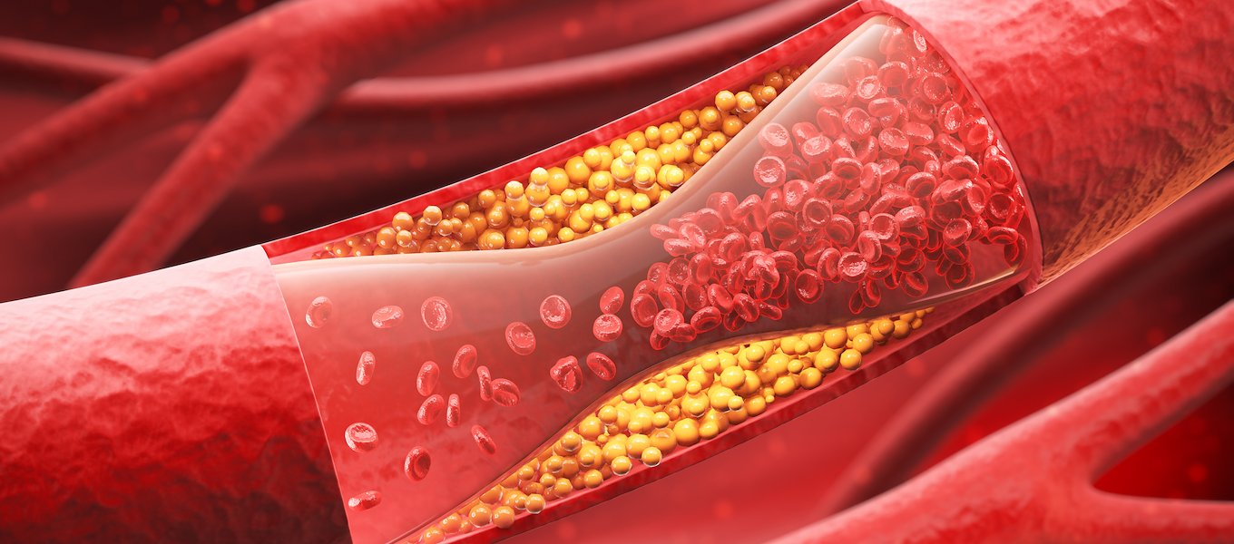 StrideCare Vascular at 6149 Windhaven Parkway, Suite 130, Plano ... — Vascular Surgery clinic in Plano, TX — photo 5