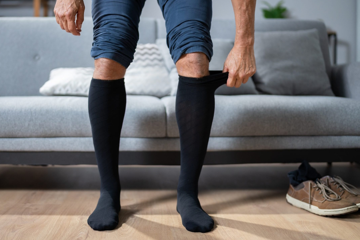 Sclerotherapy Recovery Tips: Leg Care After Vein Treatment